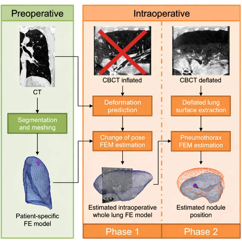 Image-guided lung-surgery pipeline. Pre-operative: a CT is segmented and meshed into a patient-specific lung model. Intra-operative phase 1: instead of acquiring an inflated-lung CBCT (shown crossed out), the change-of-pose deformation is predicted to estimate the intra-operative whole-lung model. Phase 2: a deflated-lung CBCT and a pneumothorax estimation locate the tumour nodule.