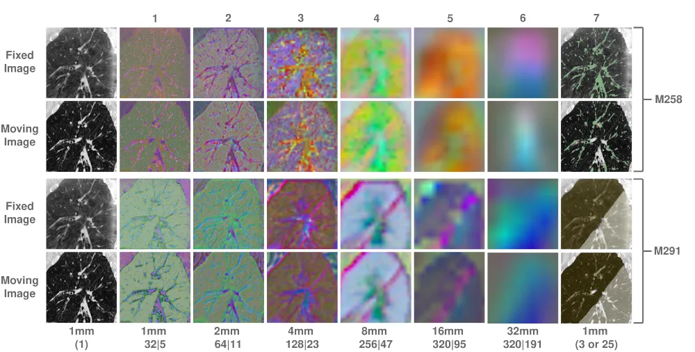 Two lung scans, a fixed and a moving image shown for two patients, mapped through a pretrained segmentation network into a sequence of feature maps, from fine appearance-like detail on the left to coarse semantic structure on the right, ending in an anatomy segmentation overlay; the same structures appear in the same place across both scans regardless of their original appearance.
