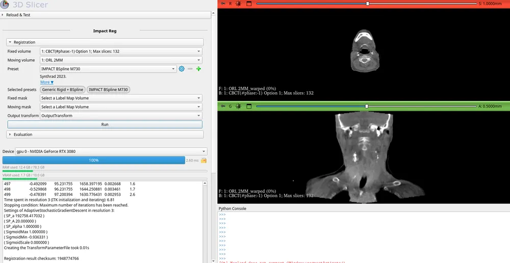 The IMPACT-Reg extension in 3D Slicer aligning a head-and-neck CT to a CBCT, with the registration panel and fused image views.