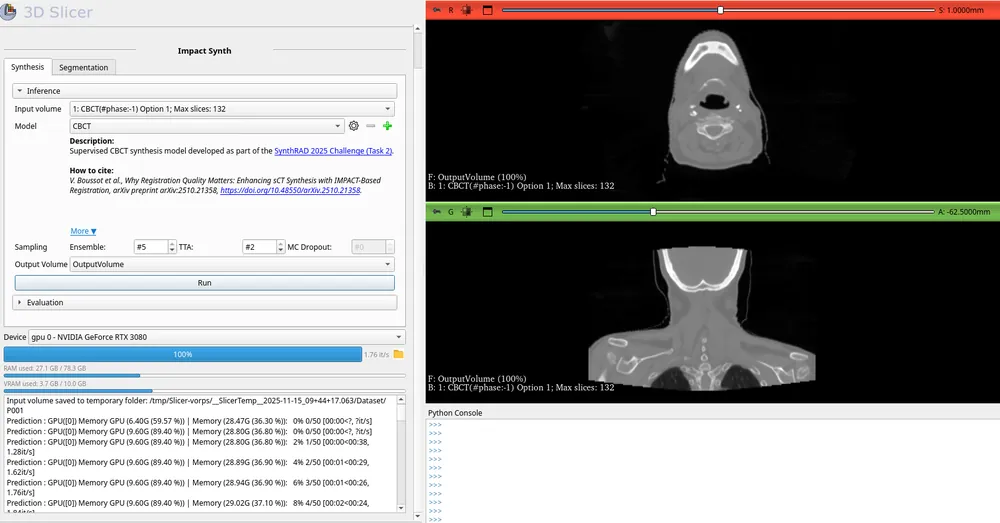 The IMPACT-Synth extension in 3D Slicer generating a synthetic CT from a CBCT, with the synthesis panel and the resulting CT-like image.
